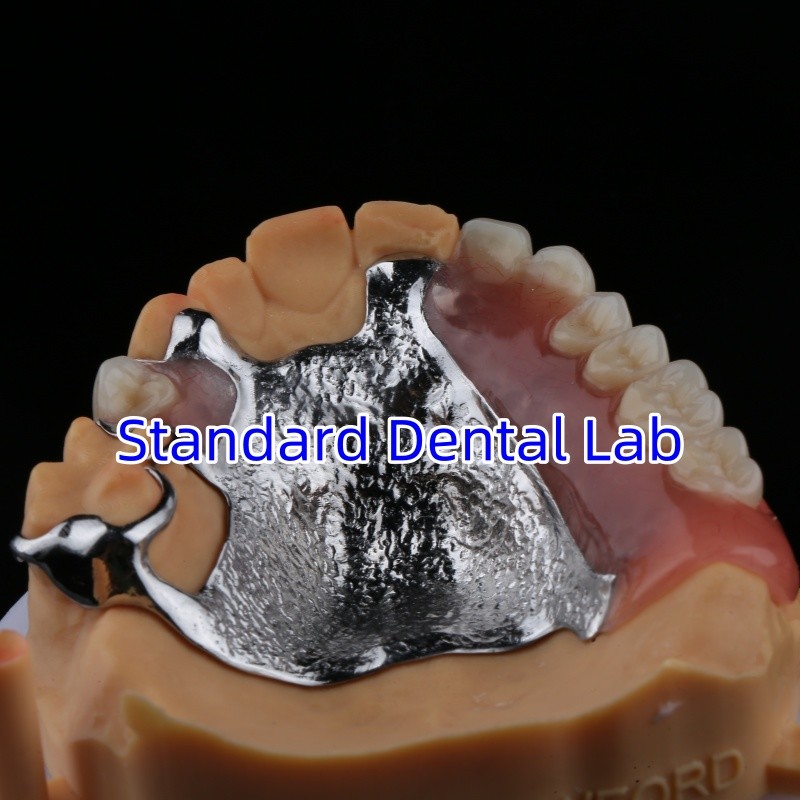 Upper Cast Framework Acrylic Metal Partial Dentures Strong Lightweight and Durable