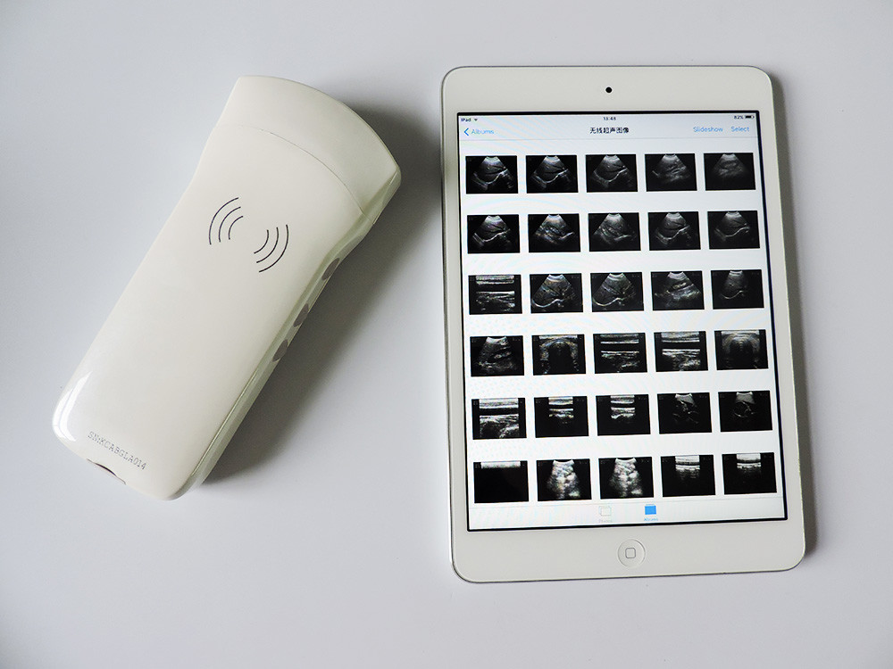5mhz C10RN Medical Hospital Equipments 128 Element Wireless Portable Ultrasound Scanner