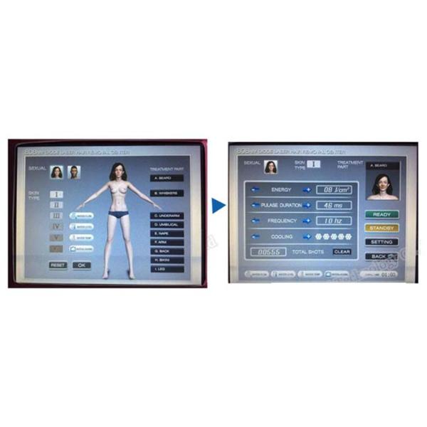 Effective Laser Beauty Machine Elight IPL For All Color Hairs Customized
