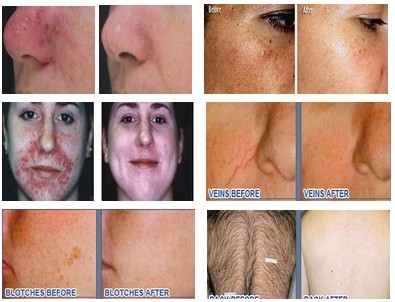 Before and After pictures.jpg