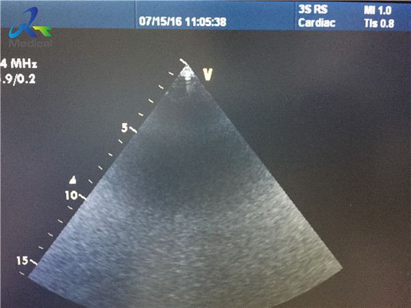Used Ultrasound Probe GE 3S-RS Phased Array Versatile/Body Ultrasound