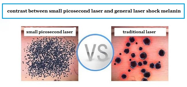 Factory price Nice quality 1064nm &532nm pigmentation removal picosure tattoo removal machine 