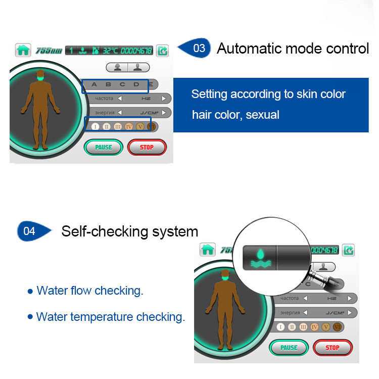 Triple Wavelength 600w Hair Removal Laser Device