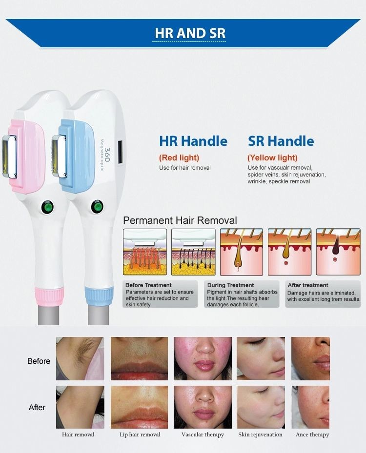 360 Magnetic SHR IPL FDA Approved Professional Laser Hair Removal Machines