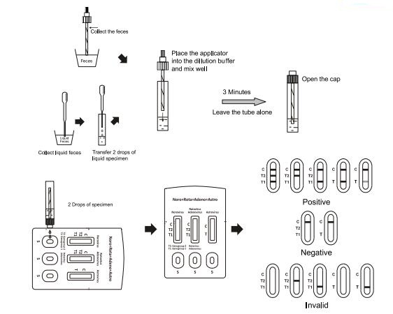 CE Norovirus, Rotavirus, Adenovirus and Astrovirus Combo Rapid Test Cassette, infectious disease