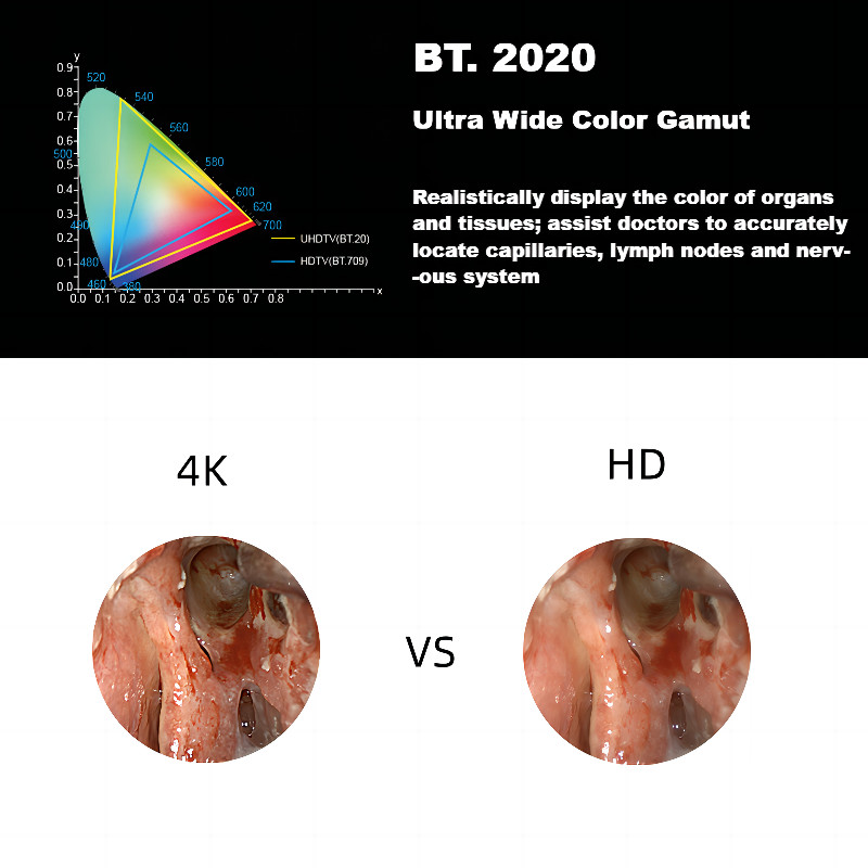 Endoscopic Camera Image System 4K Ultra HD Medical Endoscope Camera
