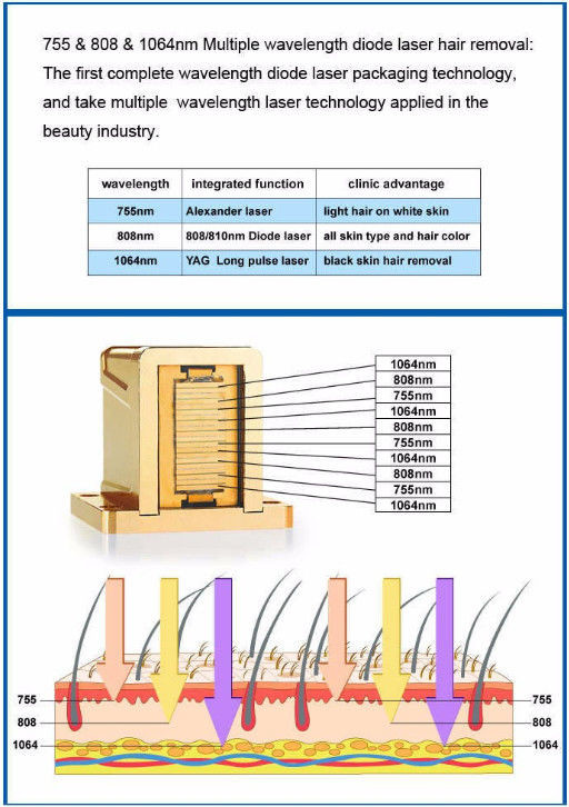 Painless 600W 808nm Diode Laser Hair Removal Germany