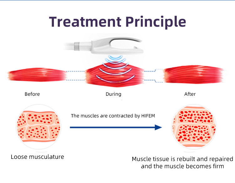 Fat Reduction Multifunctional Fat Removal Machine Combines Cryo And HIEMT