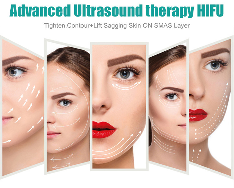 High-intensity Focused Ultrasound with Spot Size of 1-10mm Energy Level of 0.1-3J