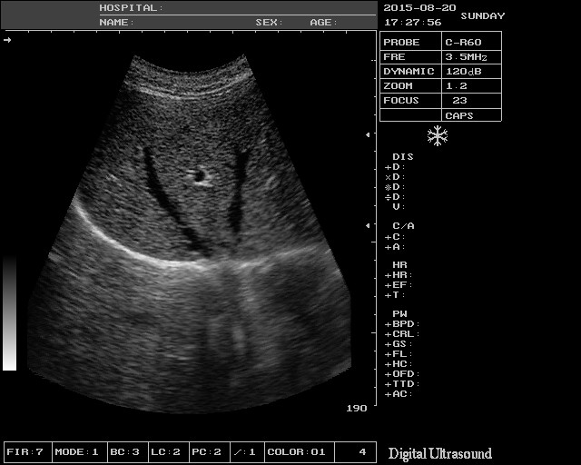 TGC Control Notebook Ultrasound Scanner For Pregnancy Home Use 9