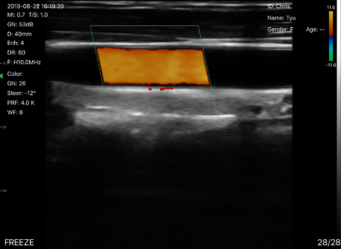 Double Head Transvaginal Array Wireless Ultrasound Probe 3.5MHZ