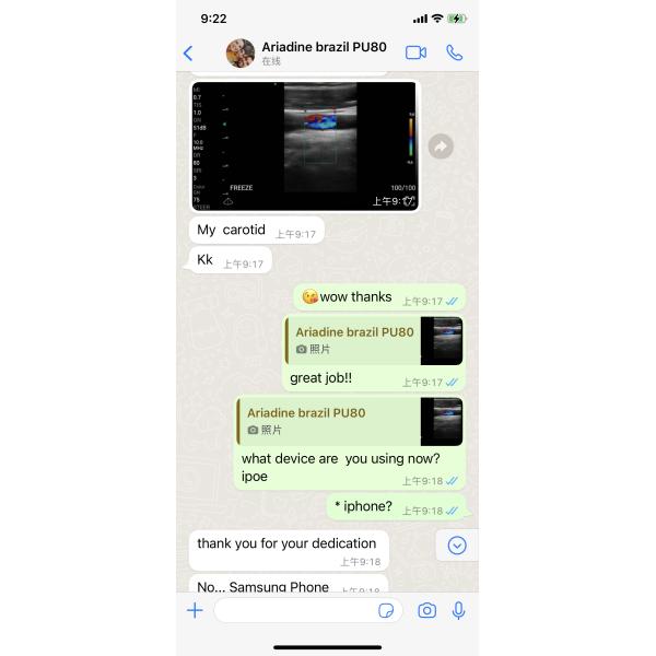 Linear/Convex/Phased Array 3 in 1 Handheld USB Ultrasound Double Probes Wireless Color Doppler Scanner