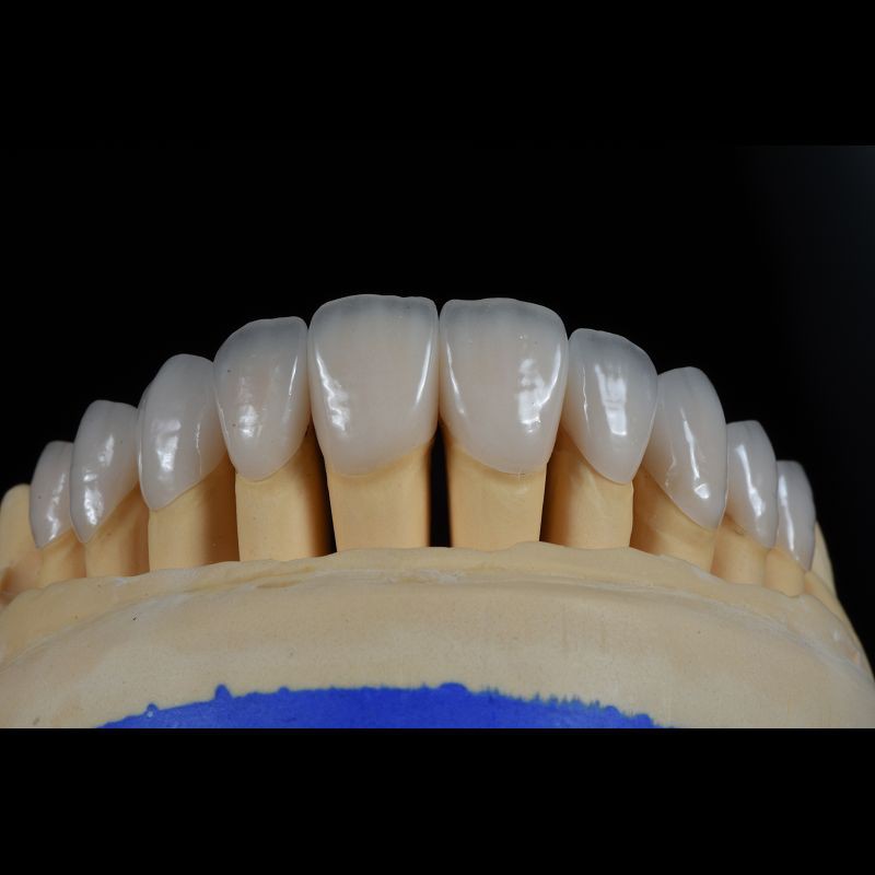Dental Lab Teeth Feldspathic Porcelain Veneers Custom Shaped