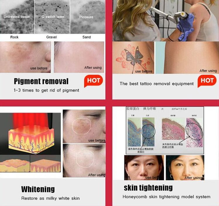 3000w picolaser Tattoo Removal Machine 500-800ps Hydro Dermabrasion