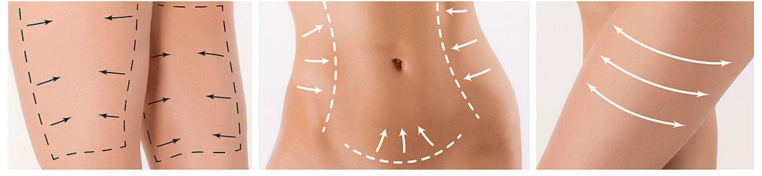 Anti Cellulite Machine Price Body Shape Slimming Cavitation Machine