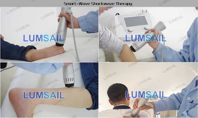 SmartWave Shock Wave Therapy Equipment For Pain Relief
