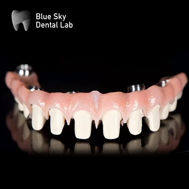 Customizable Pure Titanium Malo Bridge Dental Blue Sky Implant System