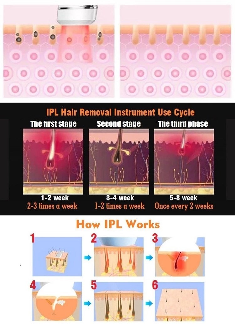 6 Weeks Permanent 240V 2.6A 450000 IPL Laser Handset