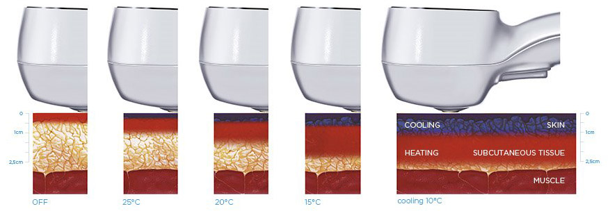 Elite Ultra 360_Heating