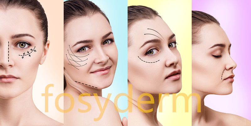 CE Certificate Hyaluronic Acid Cross Linked Dermal Filler For Fuller Lips