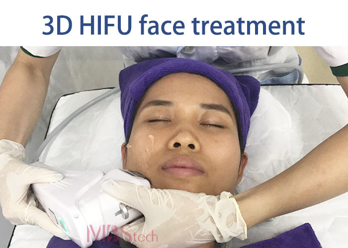 3.0mm 4.5mm Skin Tightening Weight Loss HIFU RF Machine