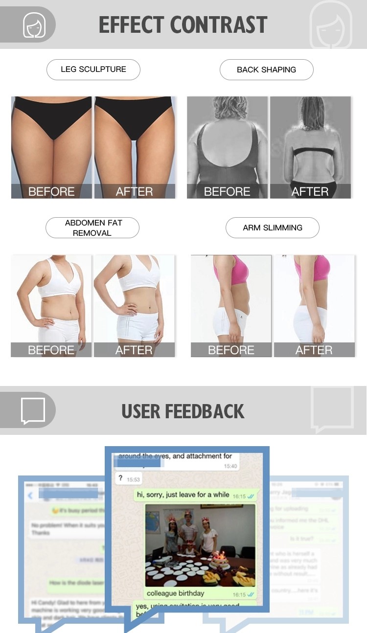Bipolar 4 Handles bodyshape Slimming Machine Radio Frequency Skin Lifting