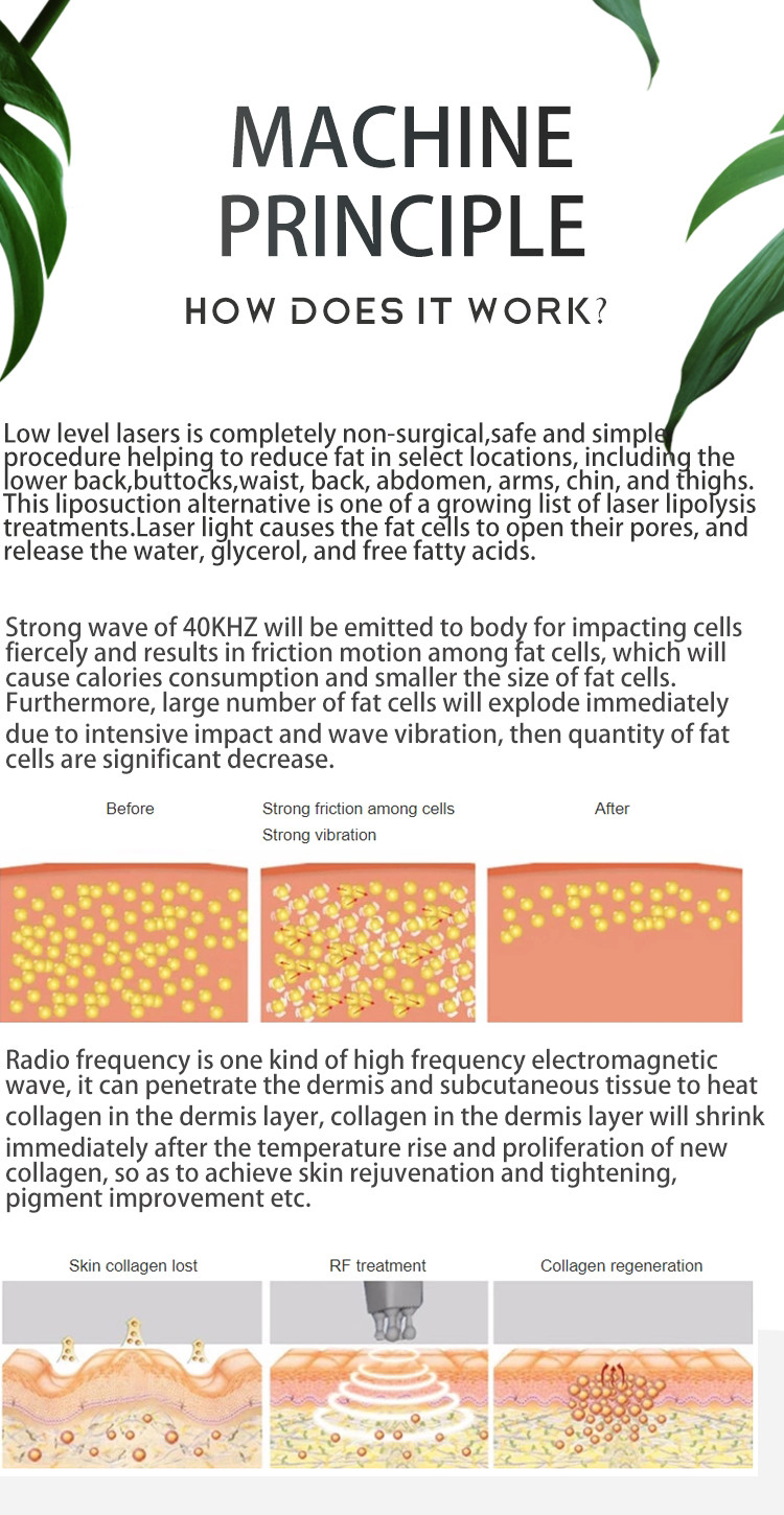 LF-265A 5 Cryo Handles 360 Cryolipolysis vacuum cavitation rf lipo laser Slimming Machine with Reduce Double Chin handle