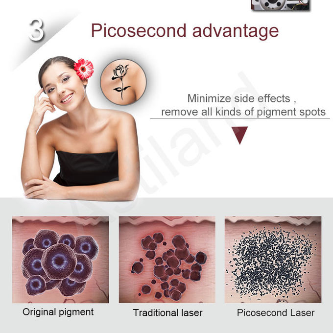 Astiland 1064nm Floor Standing Laser Tattoo Removal Machine