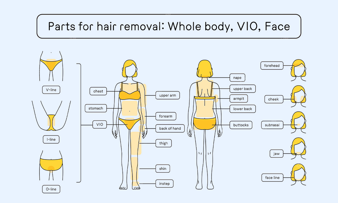 Multifunction 808nm 755nm 1060nm 1064nm Laser Hair Removal Machine