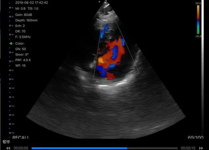 Support Printing Reports Handheld Ultrasound Scanner 13 Application 6 Language App Free IOS Android Windows Compatible 0