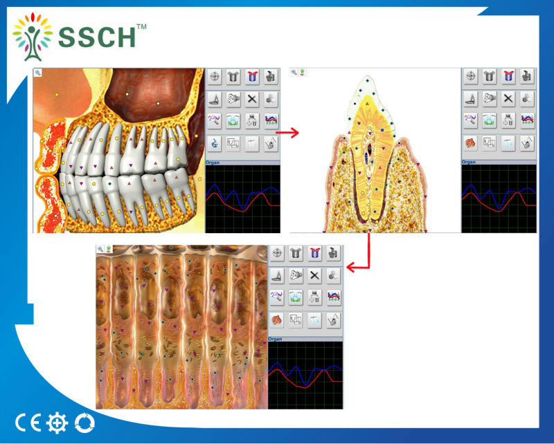 Customise Service Machinery Health Analyzer For Body Health Diagnose