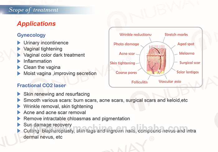 laser co2 vaginal.jpg
