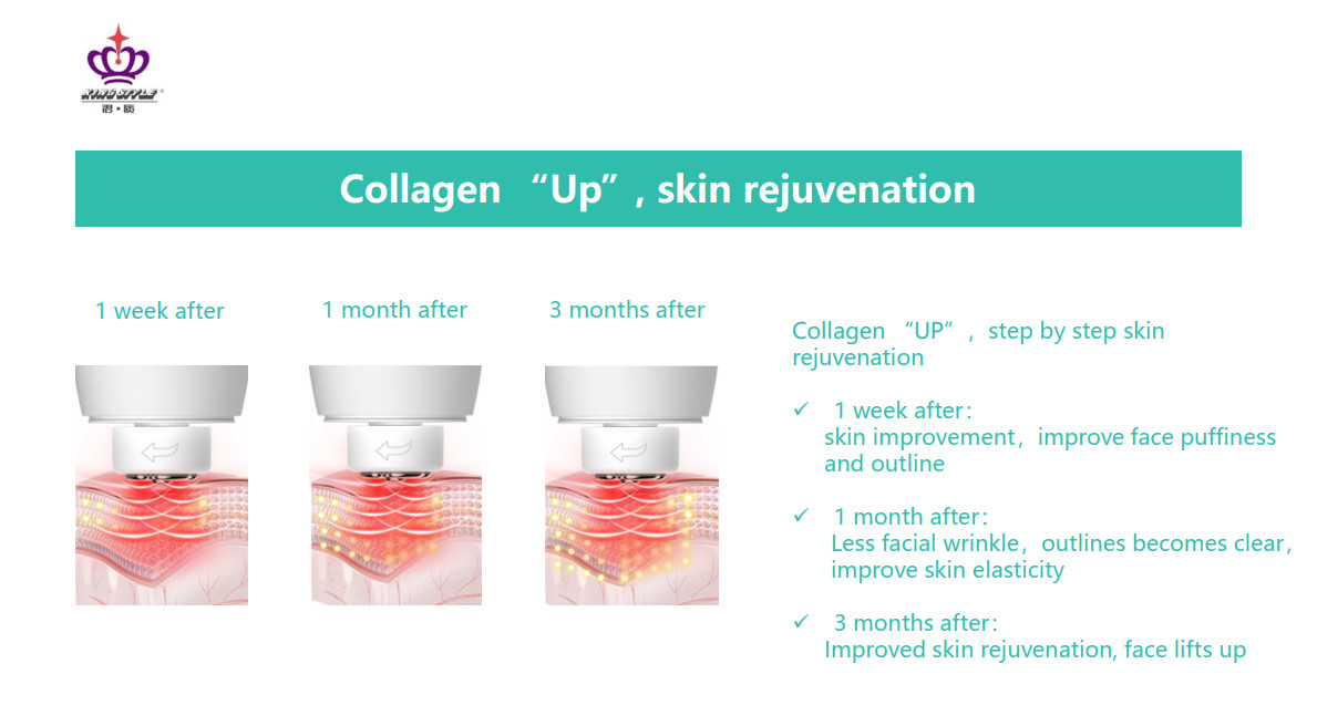 Skin Rejuvenation RF Beauty Instrument
