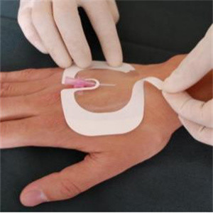 ISO13485 Adhesive Transparent Island Dressing Waterproof Wearproof