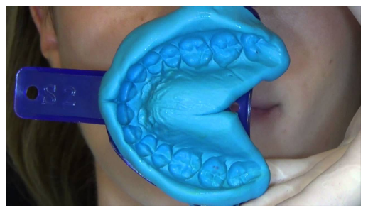 1:1 Two Part Dental Impression Silicone Mold Putty 65 Shore Environmental Non Toxic 0