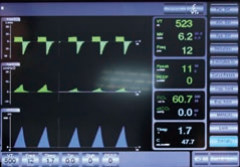 S1100 20 CmH2O-100 CmH2O Medical Ventilator Equipment Breathing Machine In ICU