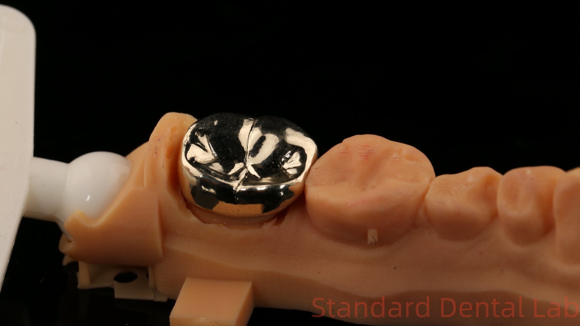 High Nobel Yellow Gold Crown Tooth Professional Ni Be Free ISO And FDA Approved China Dental Lab