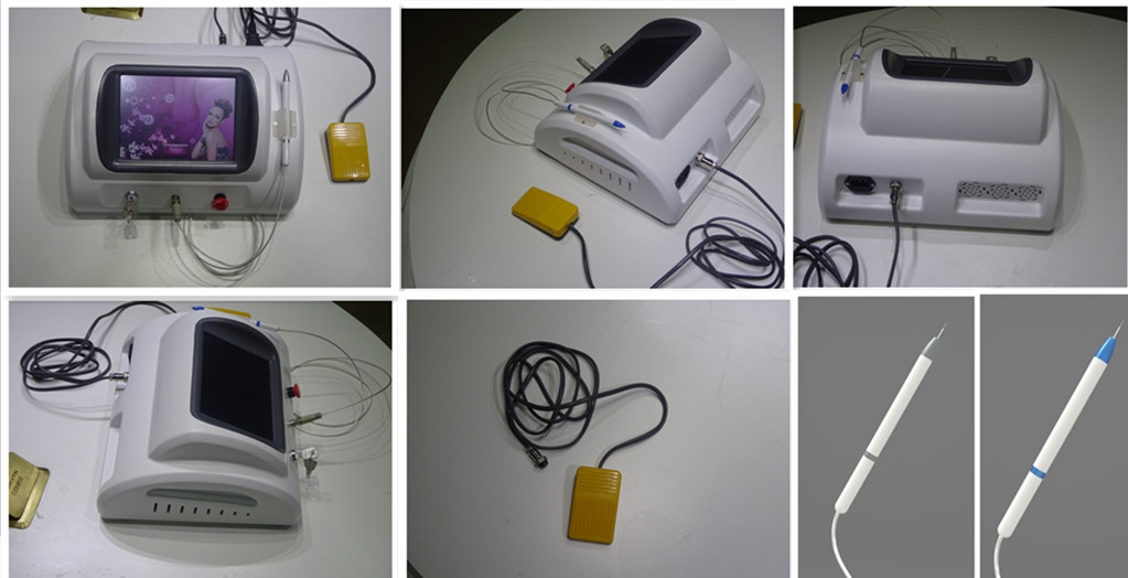 High Frequency Portable spider vein spot removal machine