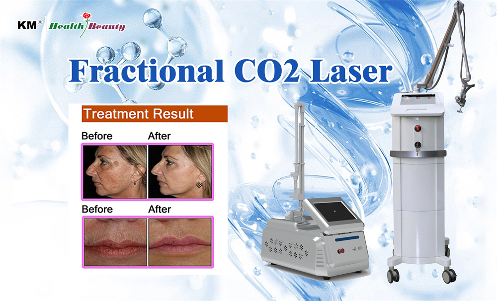 Commercial Fractional CO2 Laser Machine for Skin Resurfacing / Stretch Mark Removal