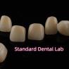 Buy cheap Dental Strong Layered Zirconia Crowns Full Upper Arch Restoration from wholesalers