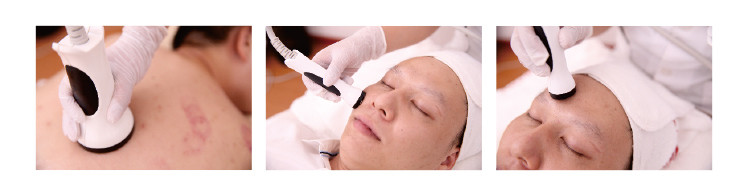 RF System 40K Cavitation Vacuum Slimming Machine Liposuction Weight Loss Machine