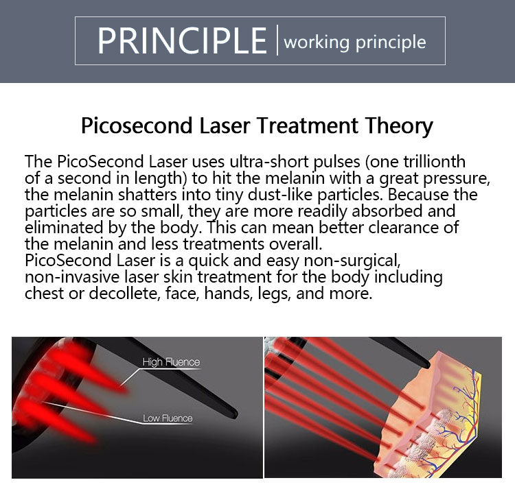 Picosecond Carbon Laser Peel Machine