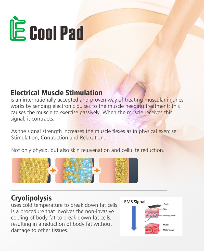 Touch Screen Home Cryolipolysis Machine 110V 60Hz Or 220v 50Hz High Efficiency