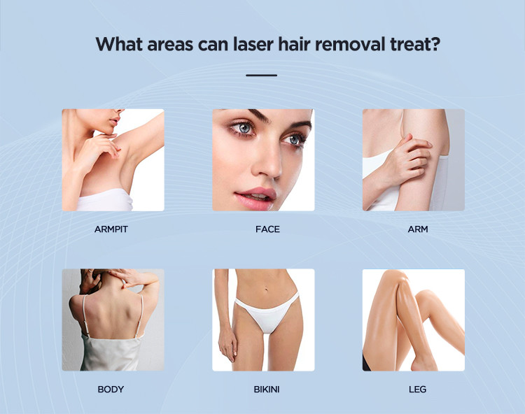 LCD 755nm+808nm+1064nm Diode Laser Hair Removal Machine With Medical CE