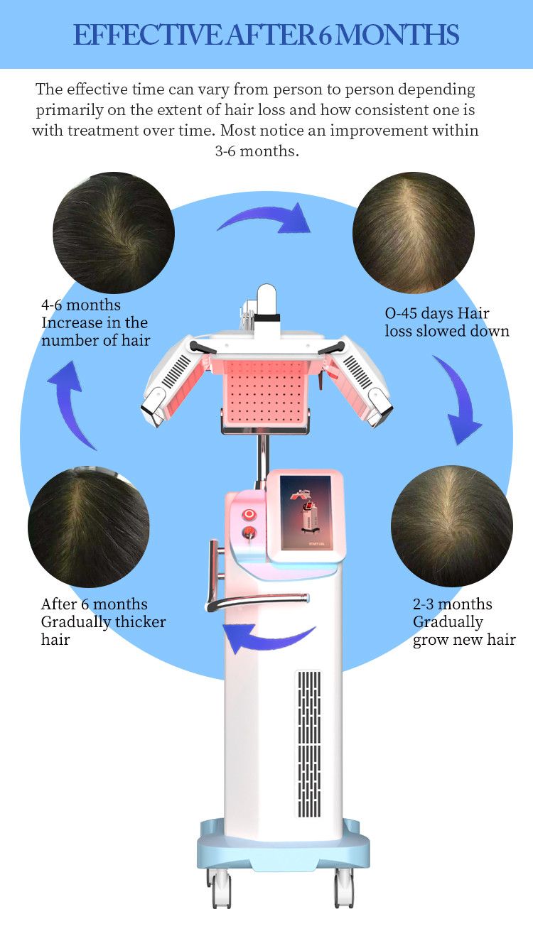 660nm Diode Laser Hair Growth Device For Hair Regeneration / Scalp Nourishment