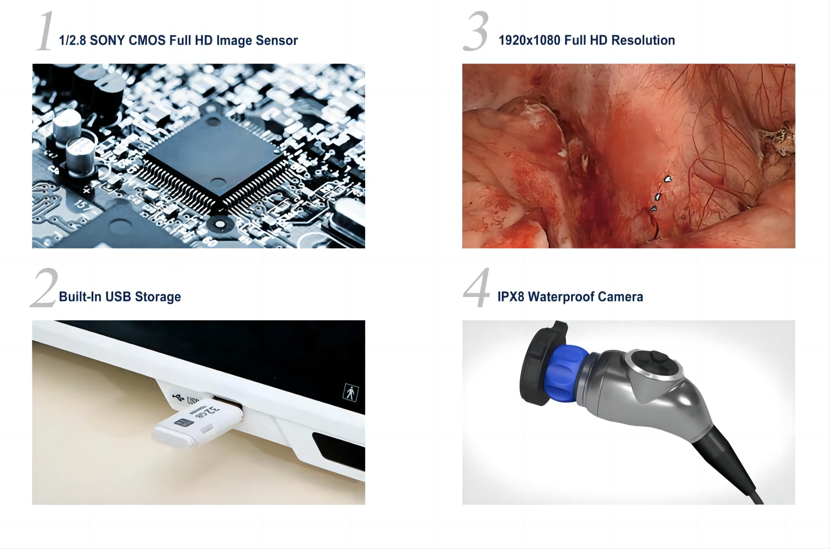 BTH-9119-T Medical Surgical Equipments IPX8 Waterproof 4K UHD Endoscope System