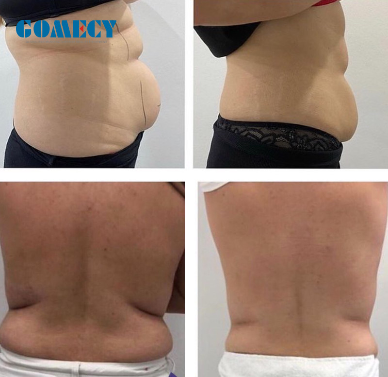 Weight Loss Lipo Massage Machine , Diode Laser Slimming Machine With 8 Paddles