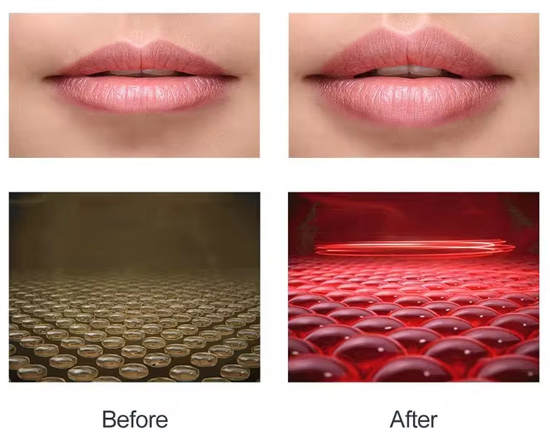 Personal Use Reduce Lip Wrinkle Lip Care Tool with Red LED Light Therapy