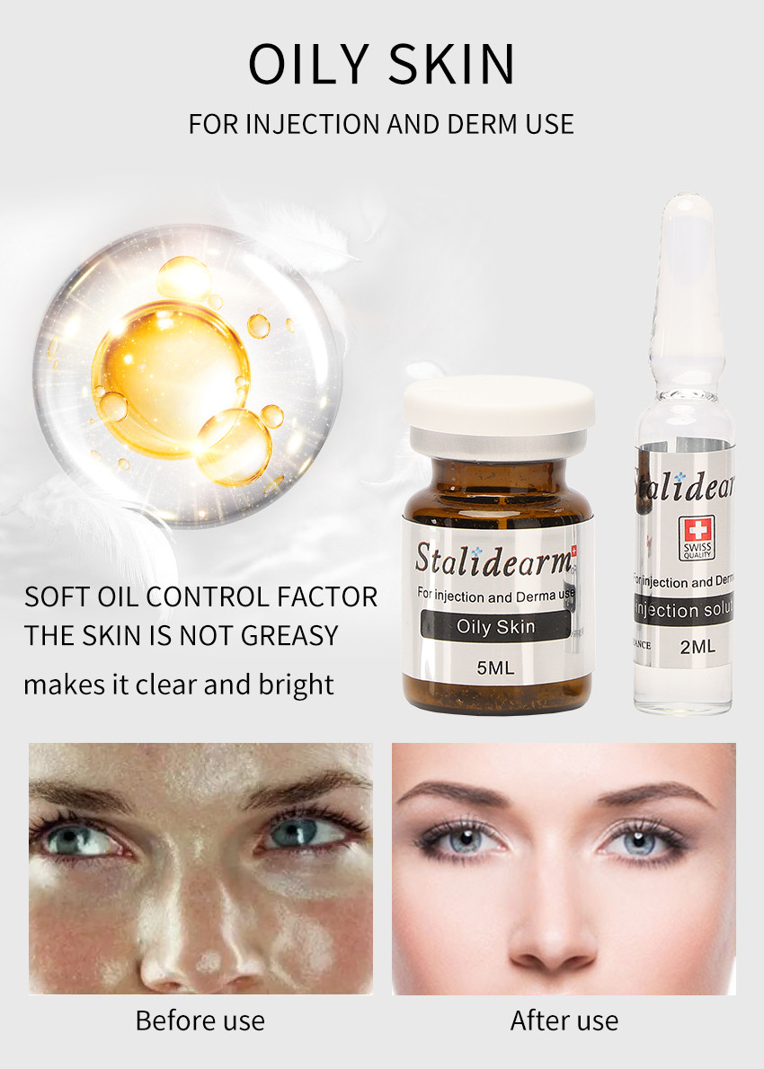Oily Youth Serum Injection ‏Oil Control Mesotherapy Skin Treatment