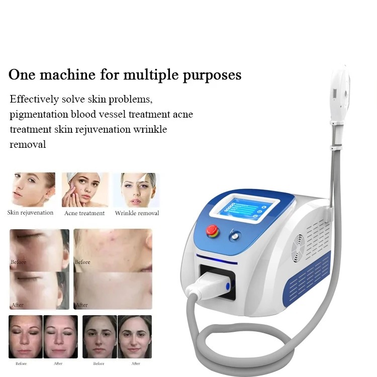 High Power Optical Filter Opt Ipl Laser Skin Rejuvenation Hair Removal Machine